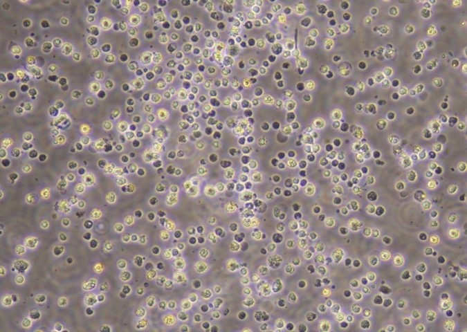 Kupffer cells_Brightfield image.jpg