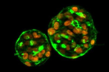 Thyrocyte_0.jpg