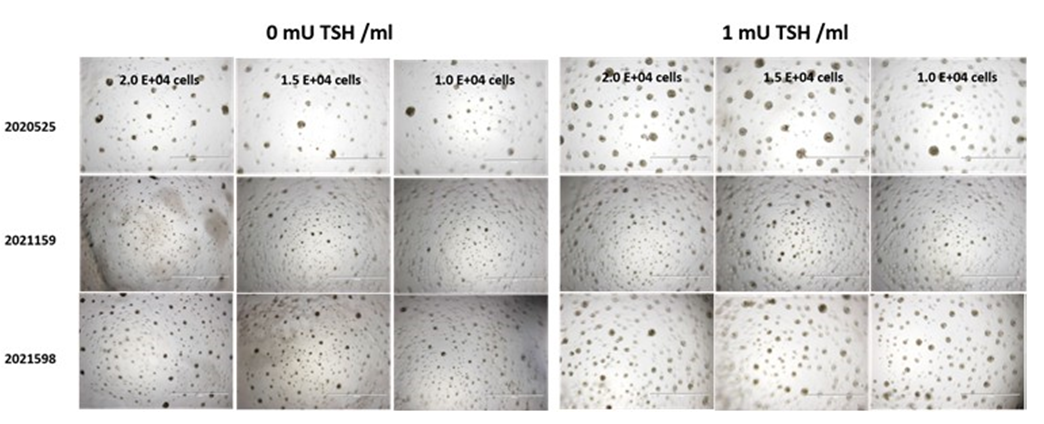 Thyroid Poster Figure 4_0.png