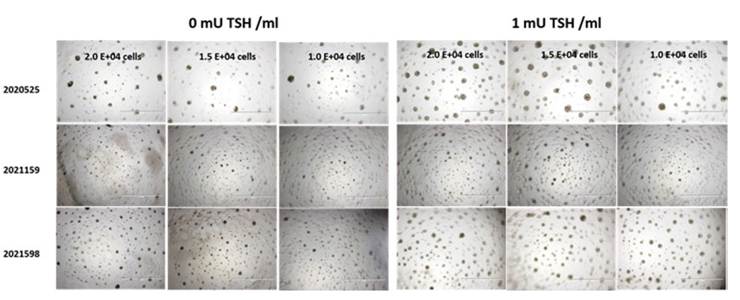 Self-assembled 3D thyroid microtissues at day 12