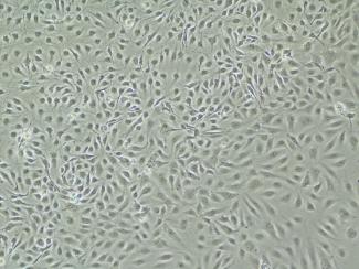 /liver-endothelial-cells