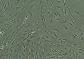 /stellate-cells
