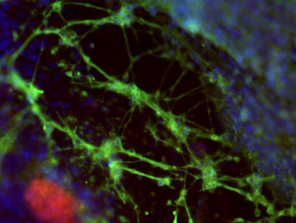 /stem-cells