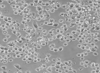 Protocol - Primary Human Kupffer Cells