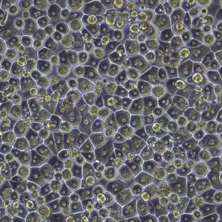 Human Hepatocyte