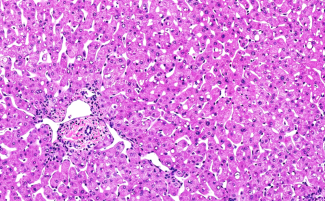 Healthy liver