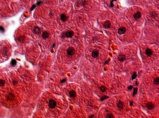 The Evolving Microenvironment of the Human Hepatocyte